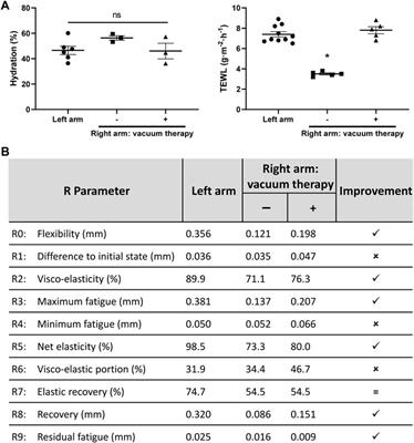 Case report: Long-term follow-up of a large full-thickness skin defect treated with a photosynthetic scaffold for dermal regeneration